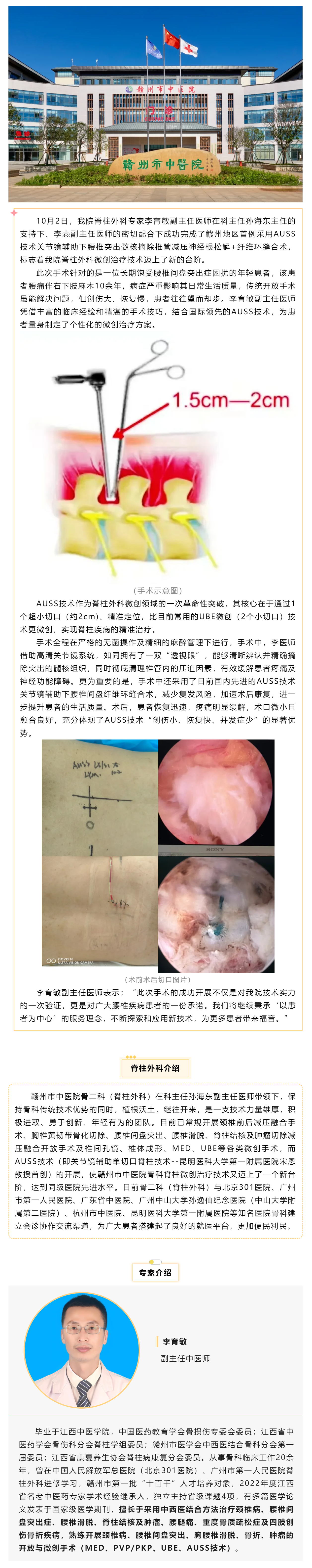 全市首例！我院成功實施AUSS技術(shù)關(guān)節(jié)鏡輔助下腰椎突出髓核摘除椎管減壓神經(jīng)根松解+纖維環(huán)縫合術(shù).png