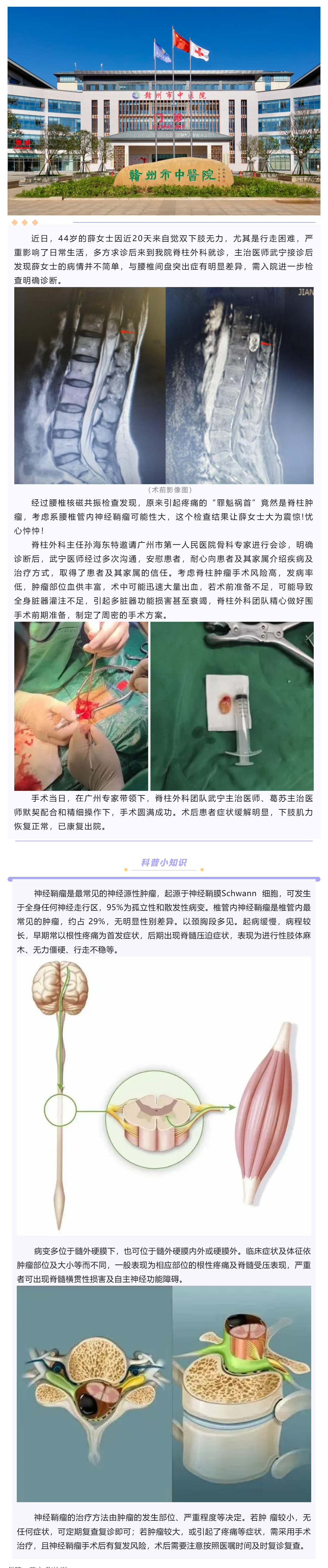 腰腿痛、下肢乏力麻木，提防神經(jīng)鞘瘤！.png